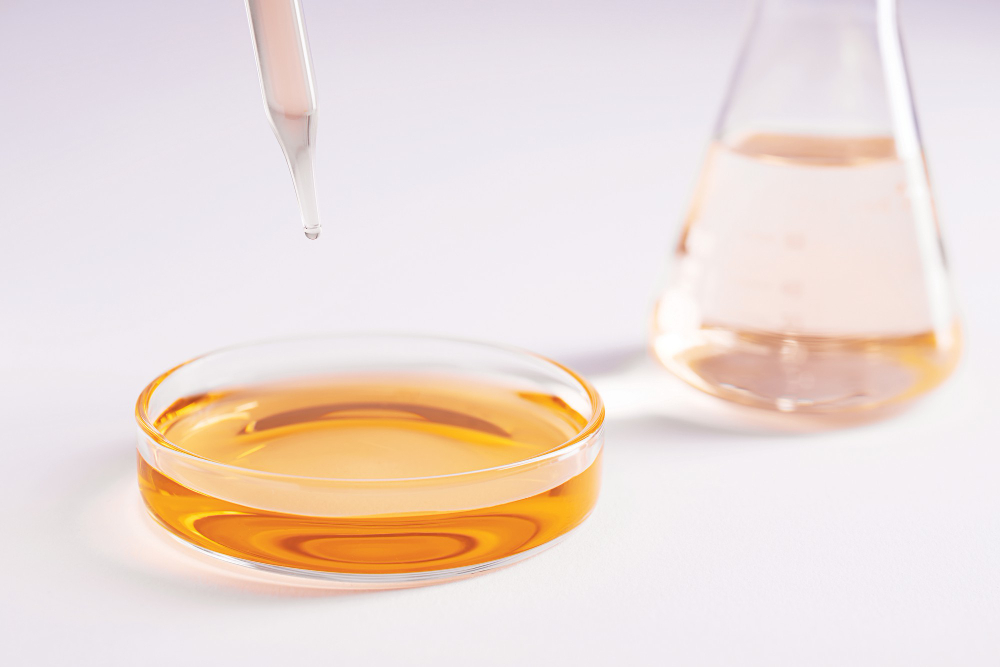 Jenis-jenis lipid